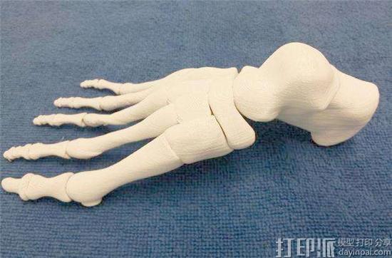 3D打印技术能在医院的骨科中有哪些应用？