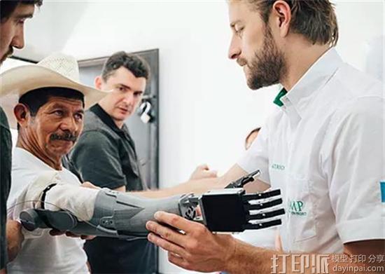 非盈利3D打印假肢组织正在争取谷歌Impact挑战赛的75万美元奖金 非盈利3D打印假肢组织正在争取谷歌Impact挑战赛的75万美元奖金