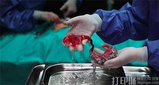 目前能用于3D打印的生物医用材料有哪些？