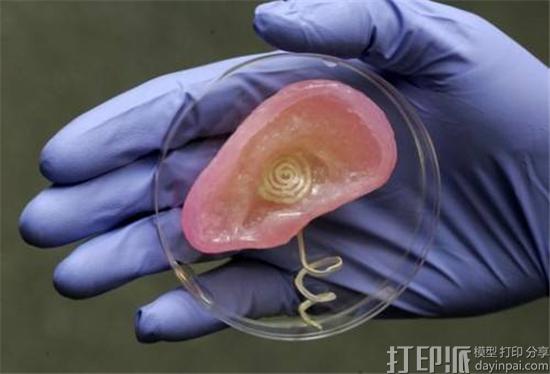 3D打印器官的发展情况如何？存在哪些难点？