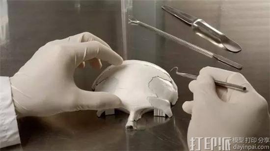 医用级的3D打印陶瓷植入物是怎么打印出来的？