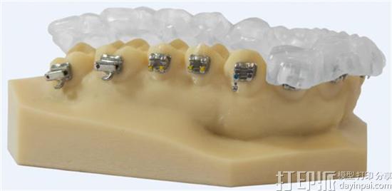 EnvisionTEC新款牙科3D打印材料：打个牙托仅需10分钟