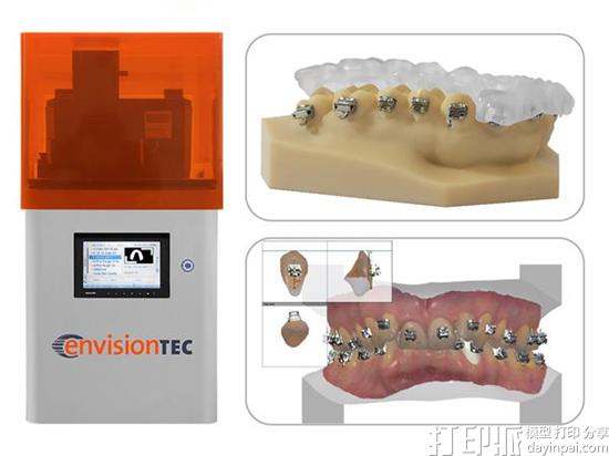 EnvisionTEC新款牙科3D打印材料：打个牙托仅需10分钟