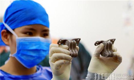一般的骨科植入物和3D打印骨科植入物有什么区别？