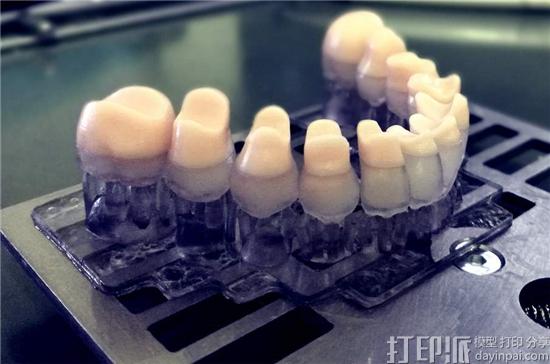 Coobx推出工业&医疗EXIGO 3D打印机 采用专利待决的LIFT技术 Coobx推出工业&医疗EXIGO 3D打印机 采用专利待决的LIFT技术