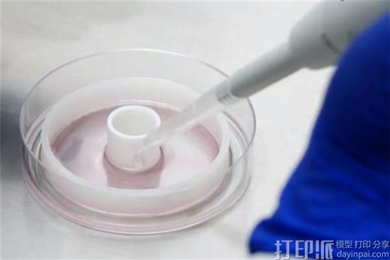 科学家开发出用3D打印导板制作定制血管的“环堆叠法” 有望改进冠心病的治疗