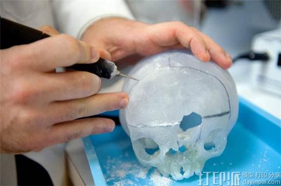 3D打印用于医疗治病会增加费用？花费更多的时间吗？
