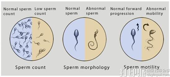 3D打印设备将手机变成精子检测套件 可检测男性生殖能力