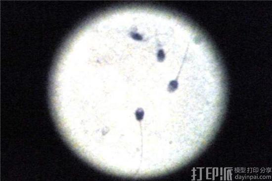 脑洞大开！ 研究人员开发出可引导精子去治疗妇科癌症的3D打印微管