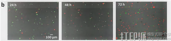 脑洞大开！ 研究人员开发出可引导精子去治疗妇科癌症的3D打印微管