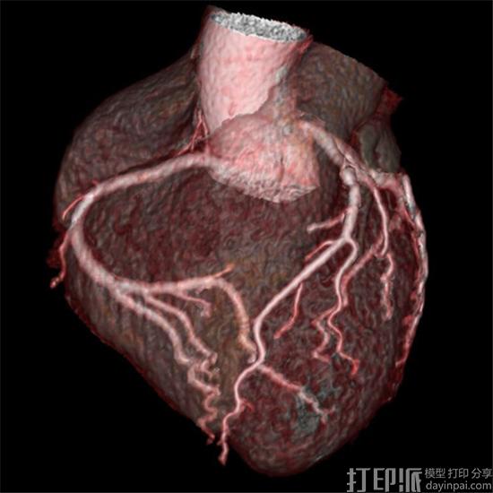 GE Healthcare正在开发一键式快速3D打印医疗模型的方法