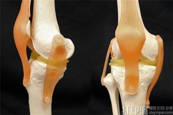 美国杜克大学研发出新型水凝胶材料 可3D打印半月板等软骨植入物 美国杜克大学研发出新型水凝胶材料 可3D打印半月板等软骨植入物