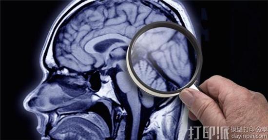 苹果最酷招聘 将曾3D打印自己脑瘤的麻省高材生招致麾下