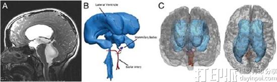 研究人员开发出用于神经外科手术训练的3D打印模型