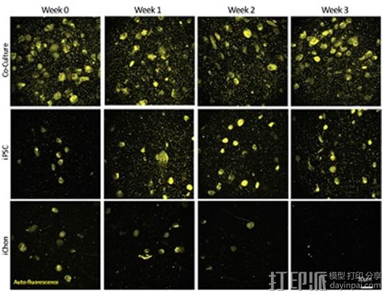 瑞典研究人员通过3D打印人体膝盖干细胞成功创建软骨组织