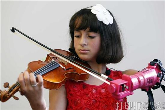 10岁女孩天生没左手 获3D打印义肢圆拉小提琴的梦想