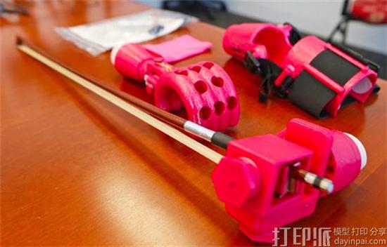 10岁女孩天生没左手 获3D打印义肢圆拉小提琴的梦想