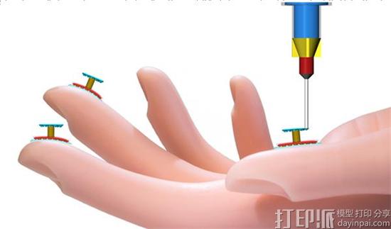 明尼苏达大学科学家开发出可直接3D打印在人手上的硅胶压力传感器