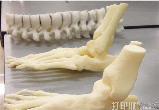 3D打印技术在骨科个体化治疗上应用的优势有哪些？
