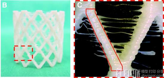 荷兰科学家开发出可生物降解的自扩展3D打印支架 适用于微创手术