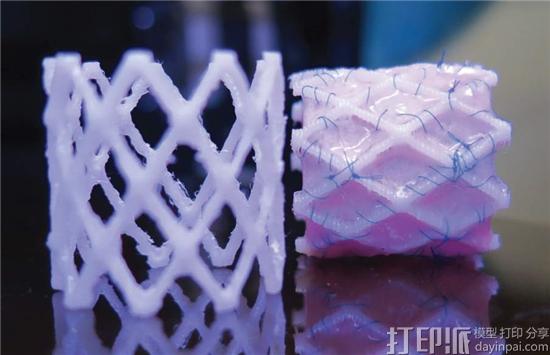 荷兰科学家开发出可生物降解的自扩展3D打印支架 适用于微创手术