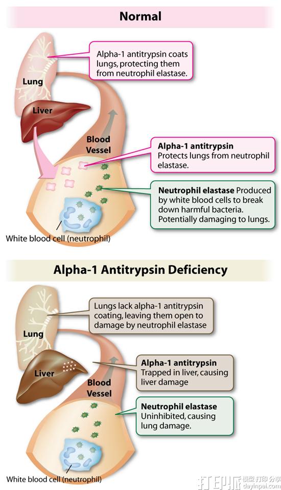 Organovo的3D打印肝脏组织在实验动物体内存活并起作用 Organovo的3D打印肝脏组织在实验动物体内存活并起作用