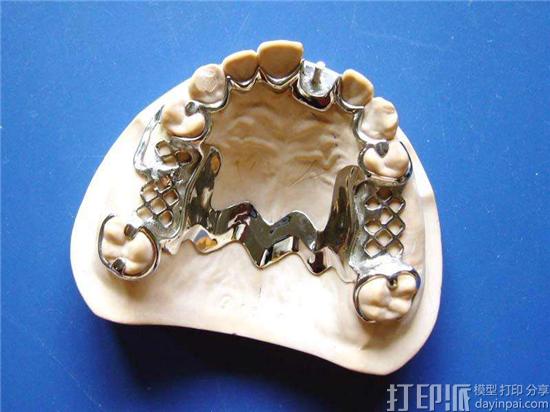 钴铬合金3D打印材料有什么优点和用处？