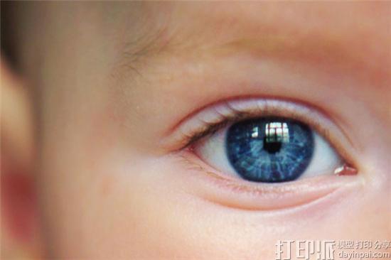 3D打印眼睛假体帮助小眼畸形或无眼畸形患儿的眼窝正常生长