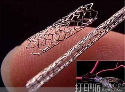 中国"3d 打印教父 "卢秉恒称:心脏支架未来可用4d打印