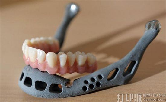 牙科3D打印市场中哪些公司做得比较好？