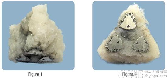 首个钛3D打印骶髂关节植入物iFuse-3D成功获得FDA批准