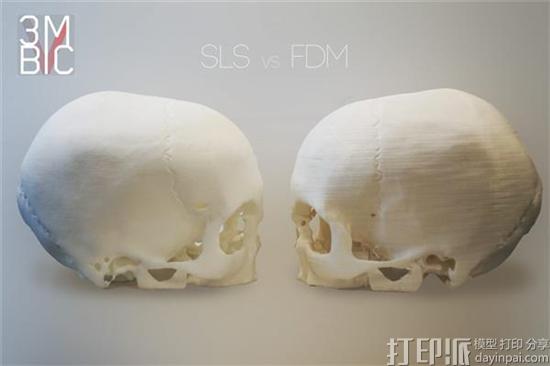 英国设计师用基于MRI扫描的3D打印头骨显示3D打印对医疗领域的影响