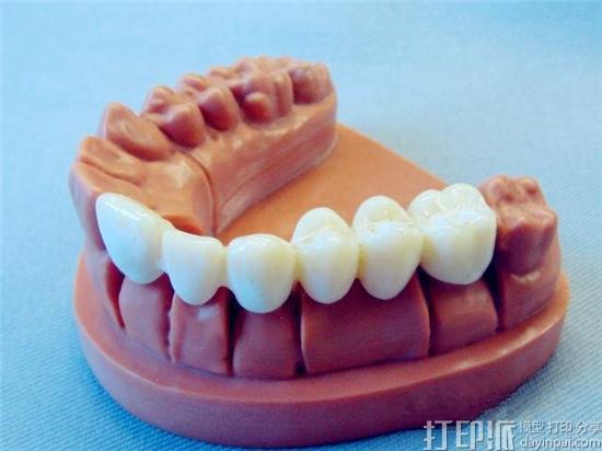 为什么看好牙科3D打印市场？
