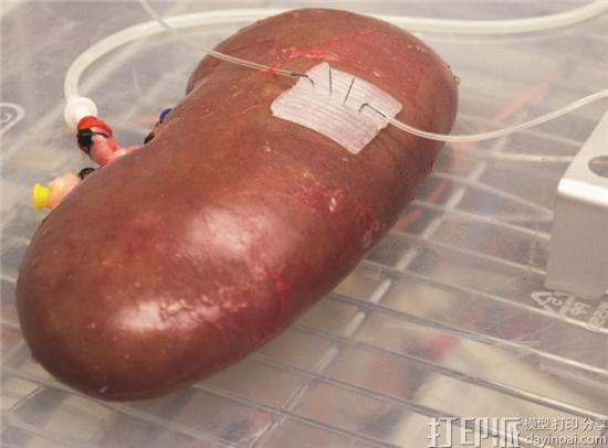 弗吉尼亚理工学院用3D打印微流体设备检查捐赠器官的健康状况