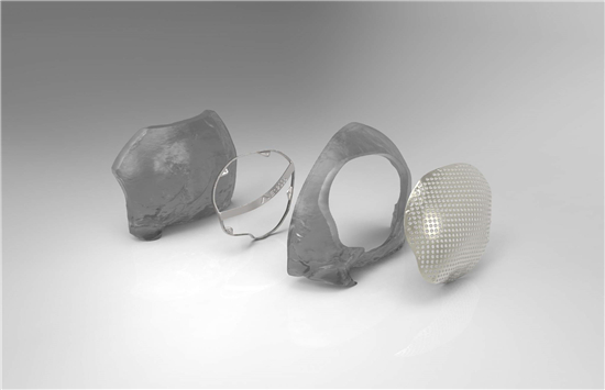 英国化学公司Johnson Matthey用贵金属3D打印抗菌假体