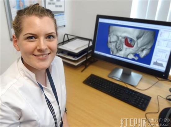 英国医院新设“生物医学3D技师”一职 专职设计和3D打印医用模型