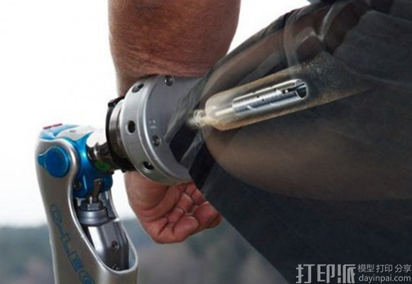 3D打印医疗植入物要怎样满足什么条件才能进入市场？