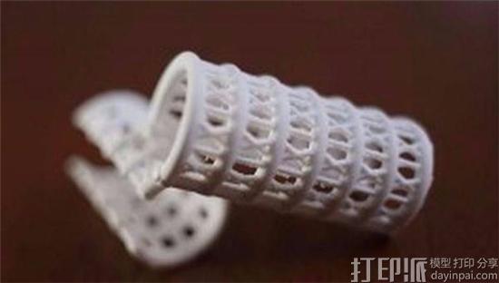 阿根廷医院用3D打印气管植入物让阿根廷女子恢复说话、进食、呼吸功能