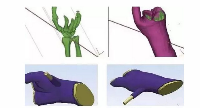 Stratasys 2017年3D打印医疗应用论坛8月将在上海召开