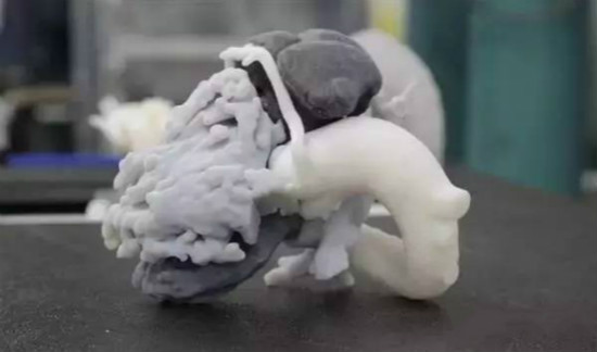 全新AW4.7智汇工作站，让医疗影像到3D打印无缝衔接 