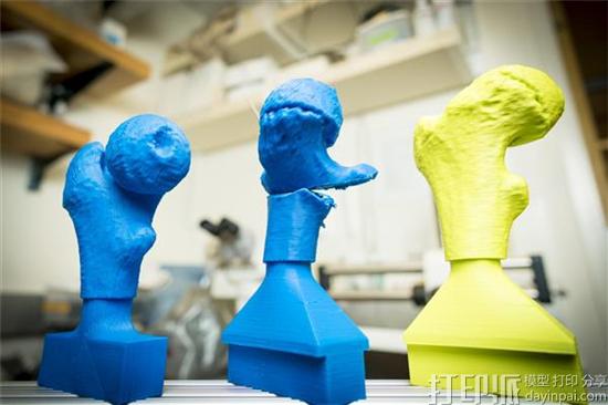 研究人员和医生使用3D打印模型将髋关节手术时间缩短25％