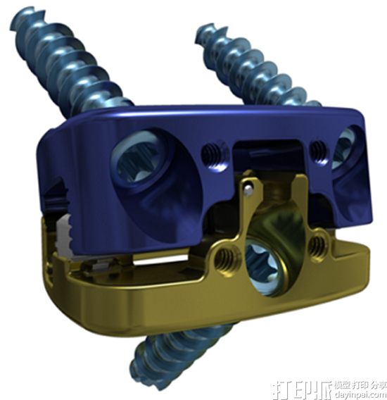 K2M宣布推出新的许可知识产权和3D打印脊柱解决方案