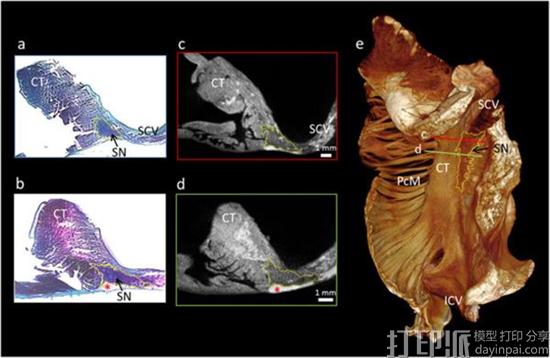 科学家开发出心脏传导系统的3D打印模型 可帮助医生研究心脏病
