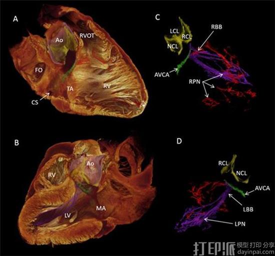 科学家开发出心脏传导系统的3D打印模型 可帮助医生研究心脏病