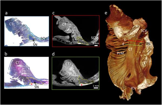 科学家开发出心脏传导系统的3D打印模型 可帮助医生研究心脏病