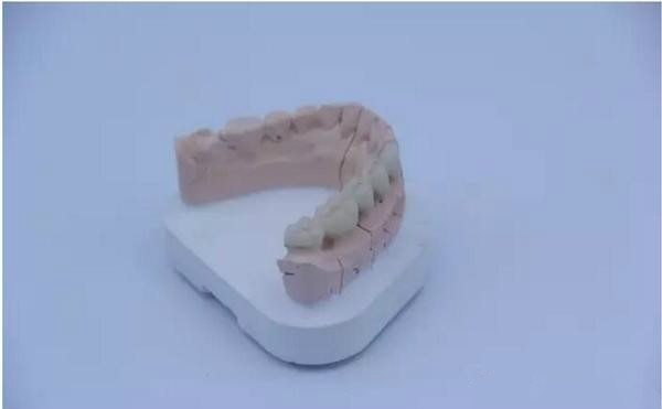 江苏永年研发的激光选区熔化义齿成形金属3D打印机YLM-120通过鉴定
