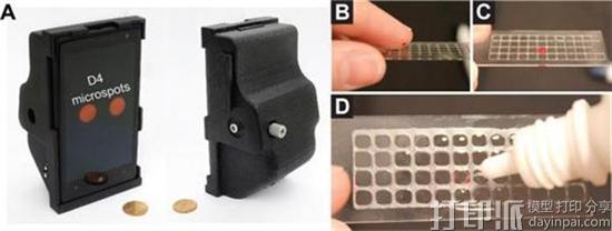 研究人员开发出可从一滴血液中检测疾病的3D打印诊断工具D4 assay