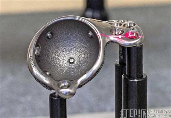 Ortho Baltic利用Nikon Metrology的扫描仪鉴定3D打印医疗植入物质量