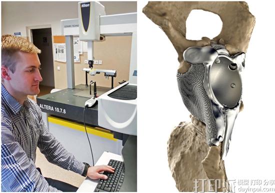 Ortho Baltic利用Nikon Metrology的扫描仪鉴定3D打印医疗植入物质量