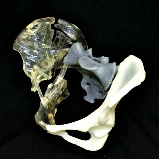 深入详解：3D打印技术在中国骨科中应用的现状和机遇 